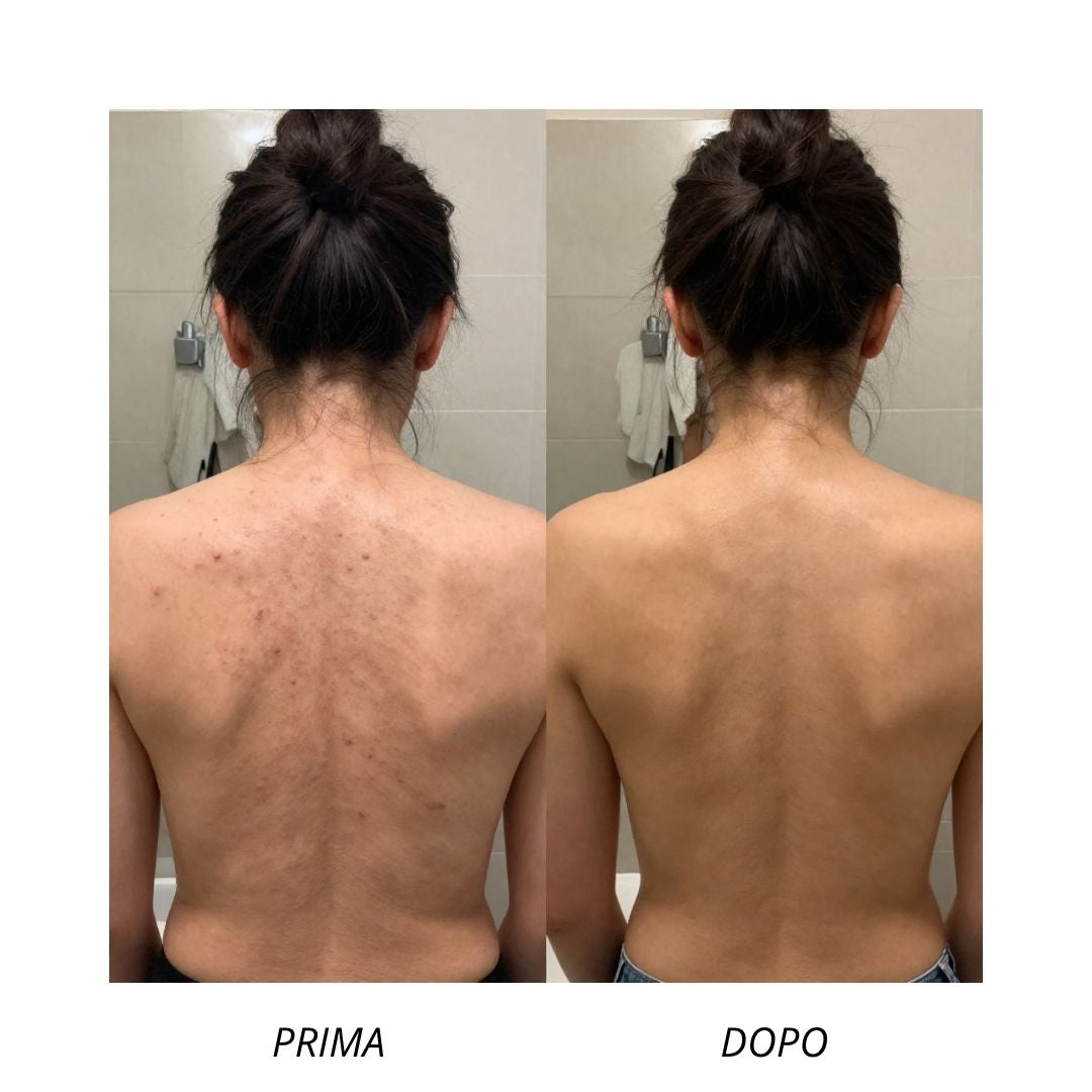 Detergente Corpo Anti-Imperfezioni Celestial Skin